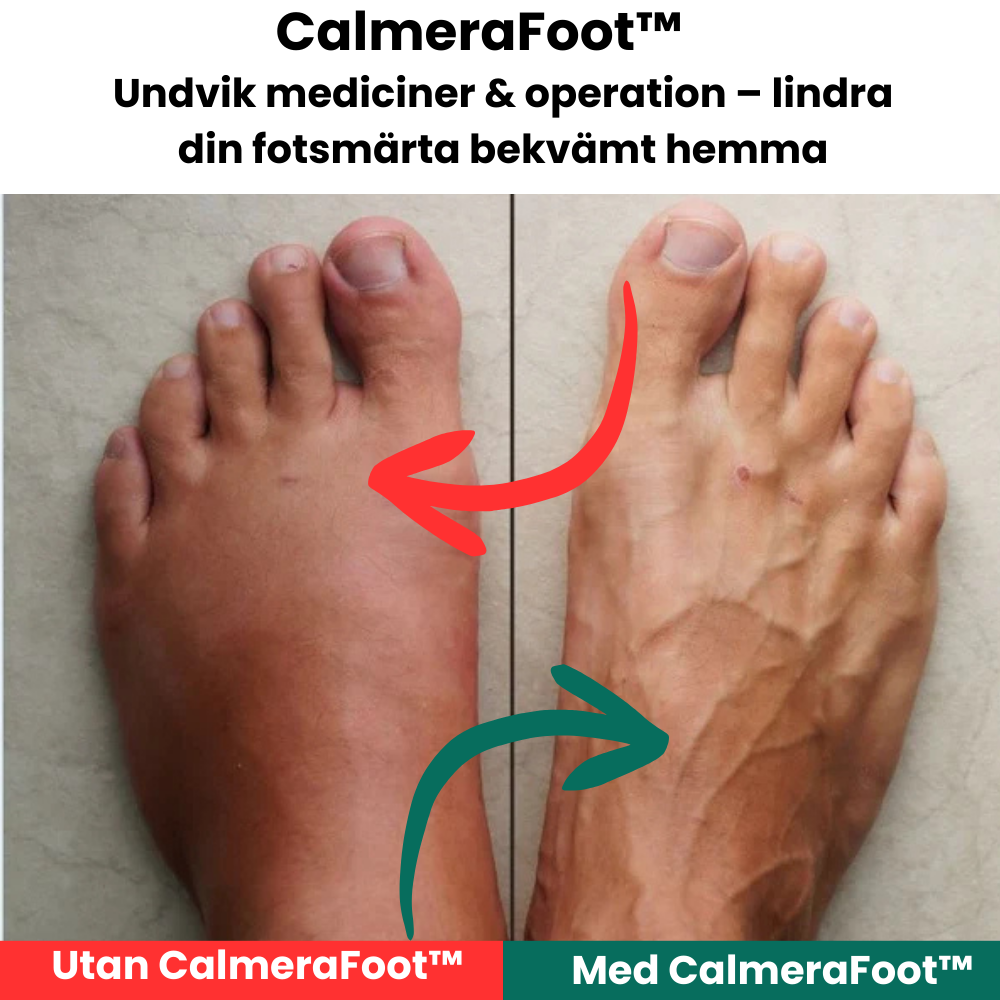 CalmeraFoot™ – Fot- och ankelmassage med värme